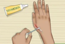 How to apply ceroxinin