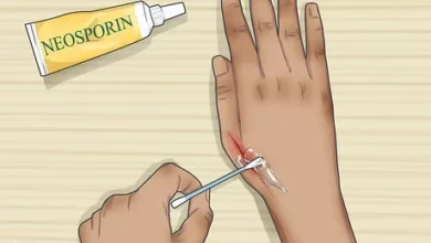 How to apply ceroxinin