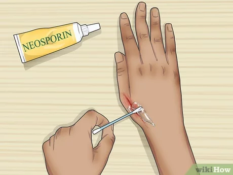 How to apply ceroxinin