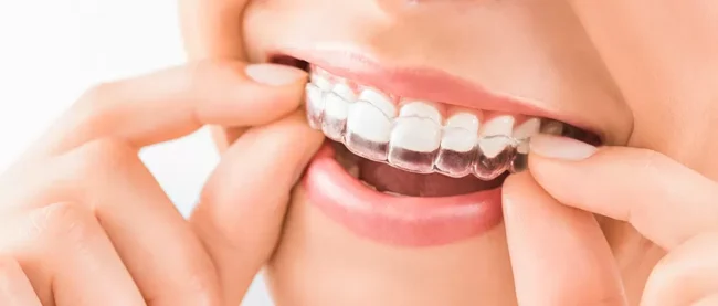 Invisalign Doctor site