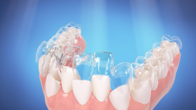 Invisalign Doctor site